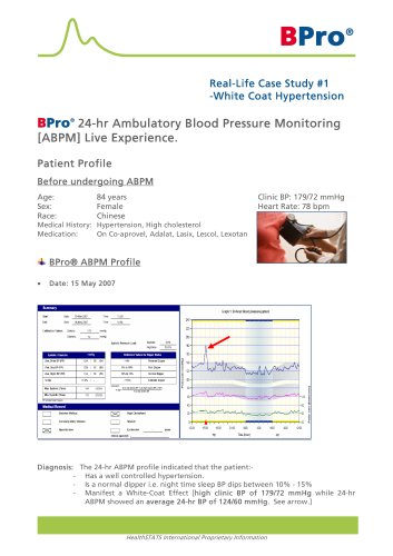 Real-Life Case Study : White Coat Hypertension