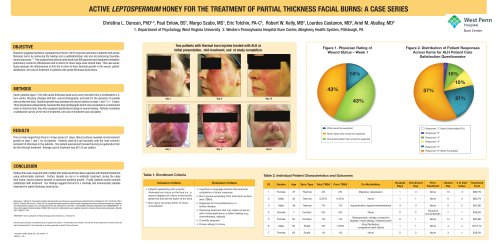 MediHoney® Poster - Aballay Partial Thickness Facial Burns