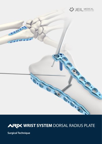 Orthopedic - ARIX Wrist System - Dorsal Radius Plate - Surgical Technique