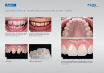 Clinical guide I - Opuscolo per lo studio odontoiatrico - 12