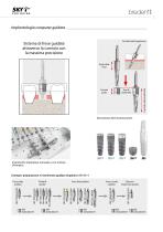 bredent medical - SKY pro guide – Sistema innovativo di chirurgia computer guidata - 3