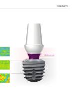 copaSKY – Sistema implantare-11