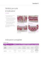 copaSKY – Sistema implantare-7