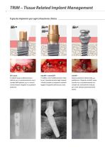 Sistema implantare SKY – DNA – Presentazione del sistema - 8