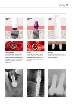 Sistema implantare SKY – DNA – Presentazione del sistema - 9