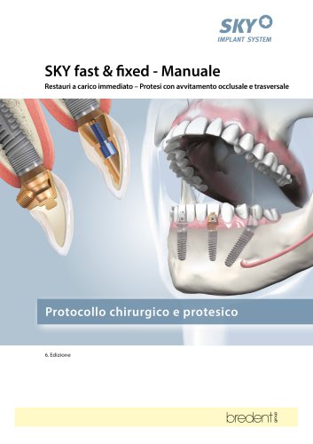 SKY fast & fixed – Manuale