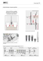 SKY pro guide – Sistema innovativo di chirurgia computer guidata - 3