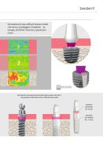 SKY Sistema implantare – blueSKY, narrowSKY, classicSKY-11