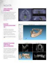 BTI Scan® 4 - Software di Pianificazione in Implantologia Orale - 3