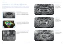 EOS COMPACT | Castellini-8