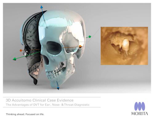 3D Accuitomo Clinical Case Evidence