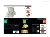 Brochure dalla scansione al bite – 100% digitale - 7