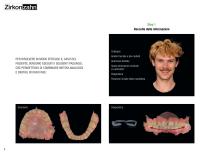 Brochure dalla scansione al bite – 100% digitale - 8