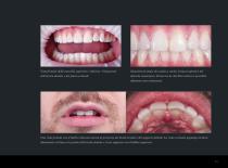 Brochure Faccette Prettau® Skin®-11