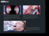 Brochure Faccette Prettau® Skin®-12
