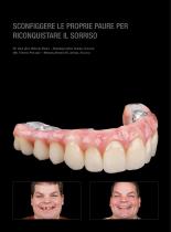 Galeria Prettau® 2 Dispersive®-3