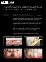 Galeria Prettau® 3 Dispersive® - 2