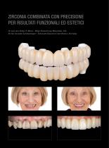 Galeria Prettau® 3 Dispersive® su ICE Plus-3