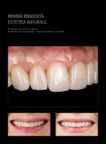 Galeria Prettau® Skin®-3