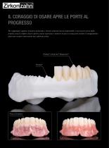 Galeria Tutto in zirconia – Florence Zircoprox Denture System - 2