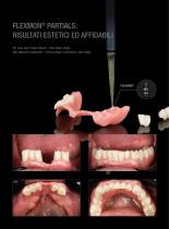 Inserto Flexmon® Partials-3