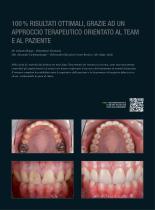 Restauro completo in zirconia  Prettau® 3 Dispersive® - 3