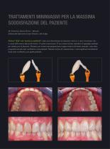 Trattamento minivasivo con con facette Prettau® 3 Dispersive® - 3