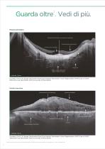 DRI OCT Triton™ Series - 6