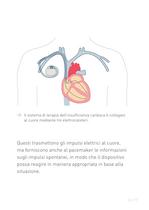 Congestive Heart Failure Therapy System - 17