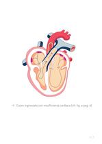 Congestive Heart Failure Therapy System - 9