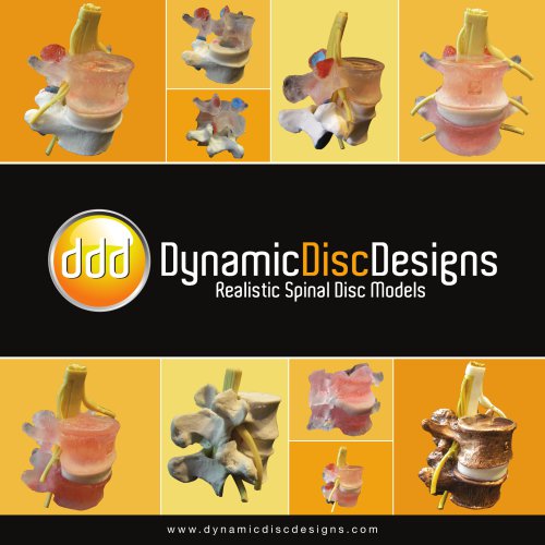 Dynamic Disc Models