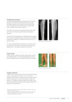 Expert Tibial Nail PROtect - 11