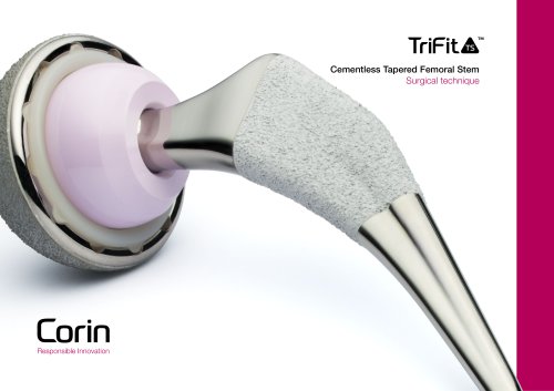 TriFit TS surgical technique