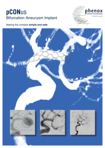 pCONus Bifurcation Aneurysm Implant