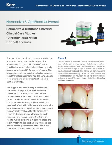 Harmonize&trade; & OptiBond&trade; Universal Restorative Case Study