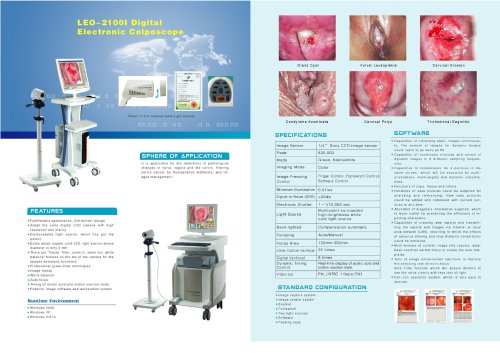 LEO-2100I colposcopy