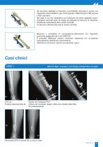 FEP Monouso - 5